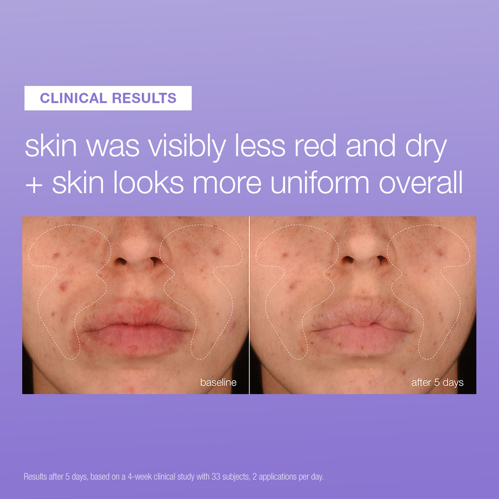 UltraCalming Stabilizing Repair Serum 50ml