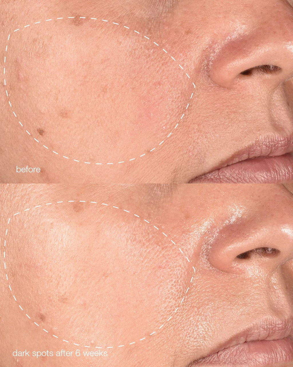 Pro MelanoPro Peeling System 4pk