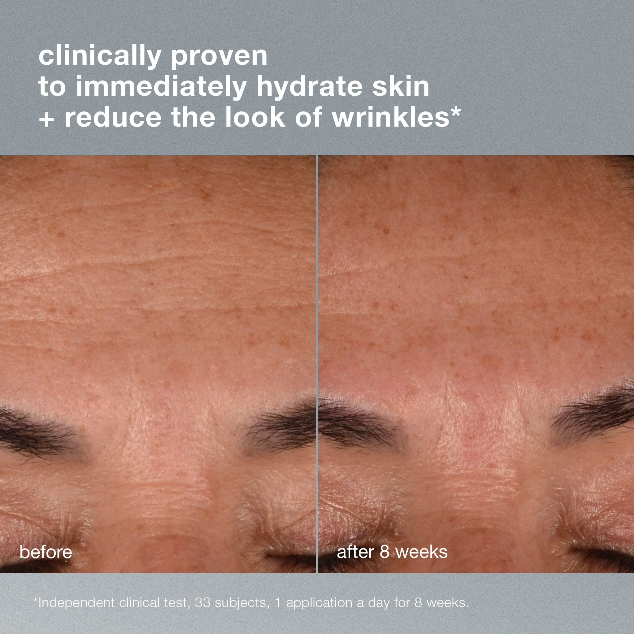 Dynamic Skin Recovery Spf50 Moisturiser