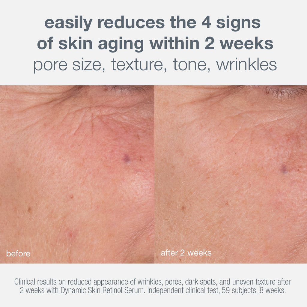 skin aging solutions