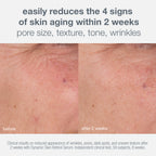 skin aging solutions